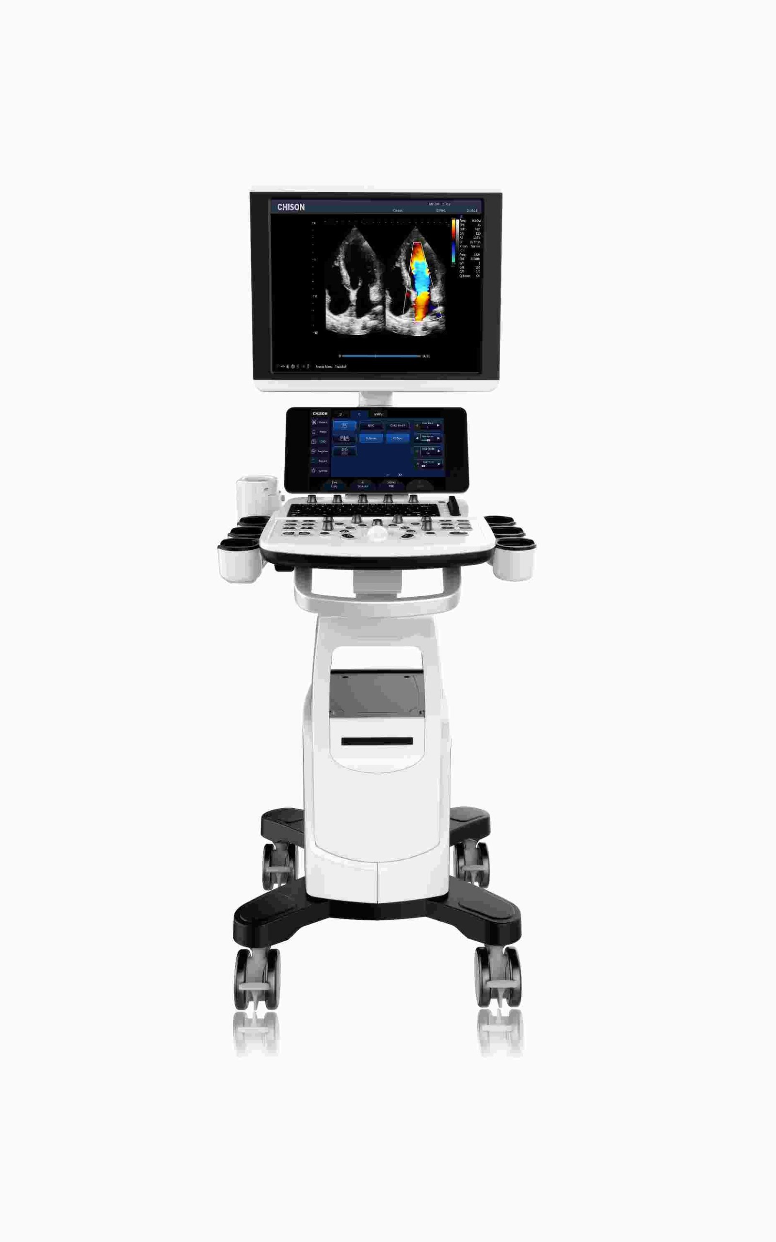 Ultrasound Machine